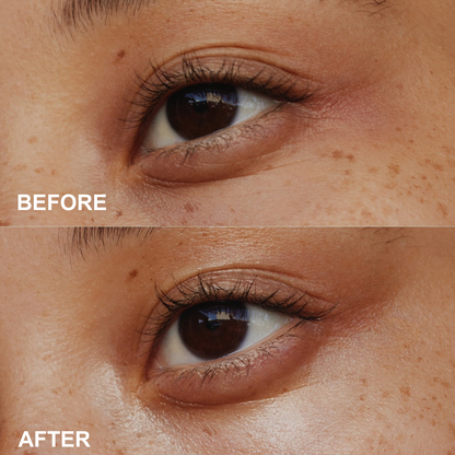 Orvelia Milano × PHOFAY — Age-Defying Eye Repair Cream